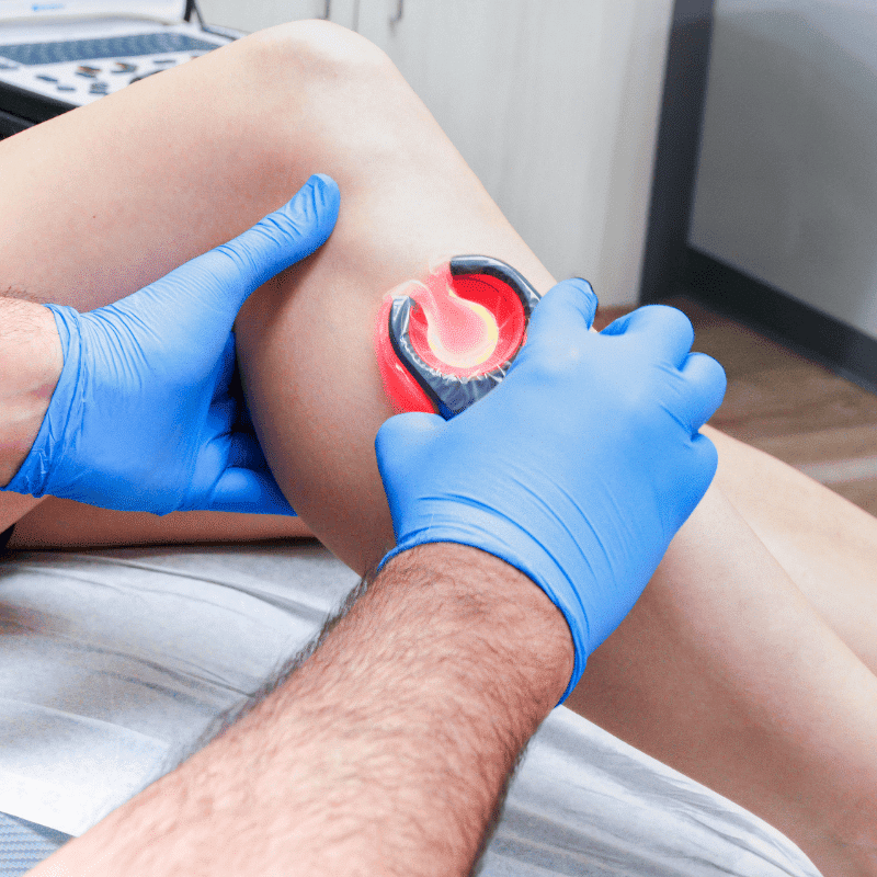 Vein Specialist in CT